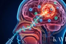 العلاج الدقيق للورم الدبقي من خلال توصيل خلايا المناعة المتبناة عبر الأنف: بروتوكول مبتكر من فريق الأستاذ أنس ديفان في مستشفى سيول سانغمو